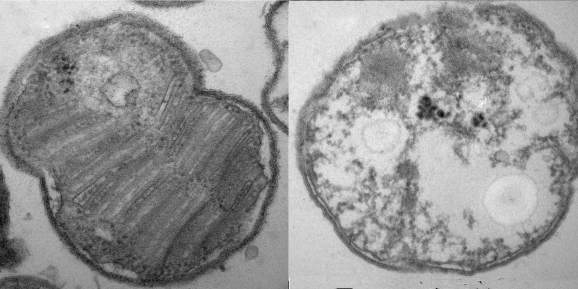 Bacterial cells with and without protective membranes.