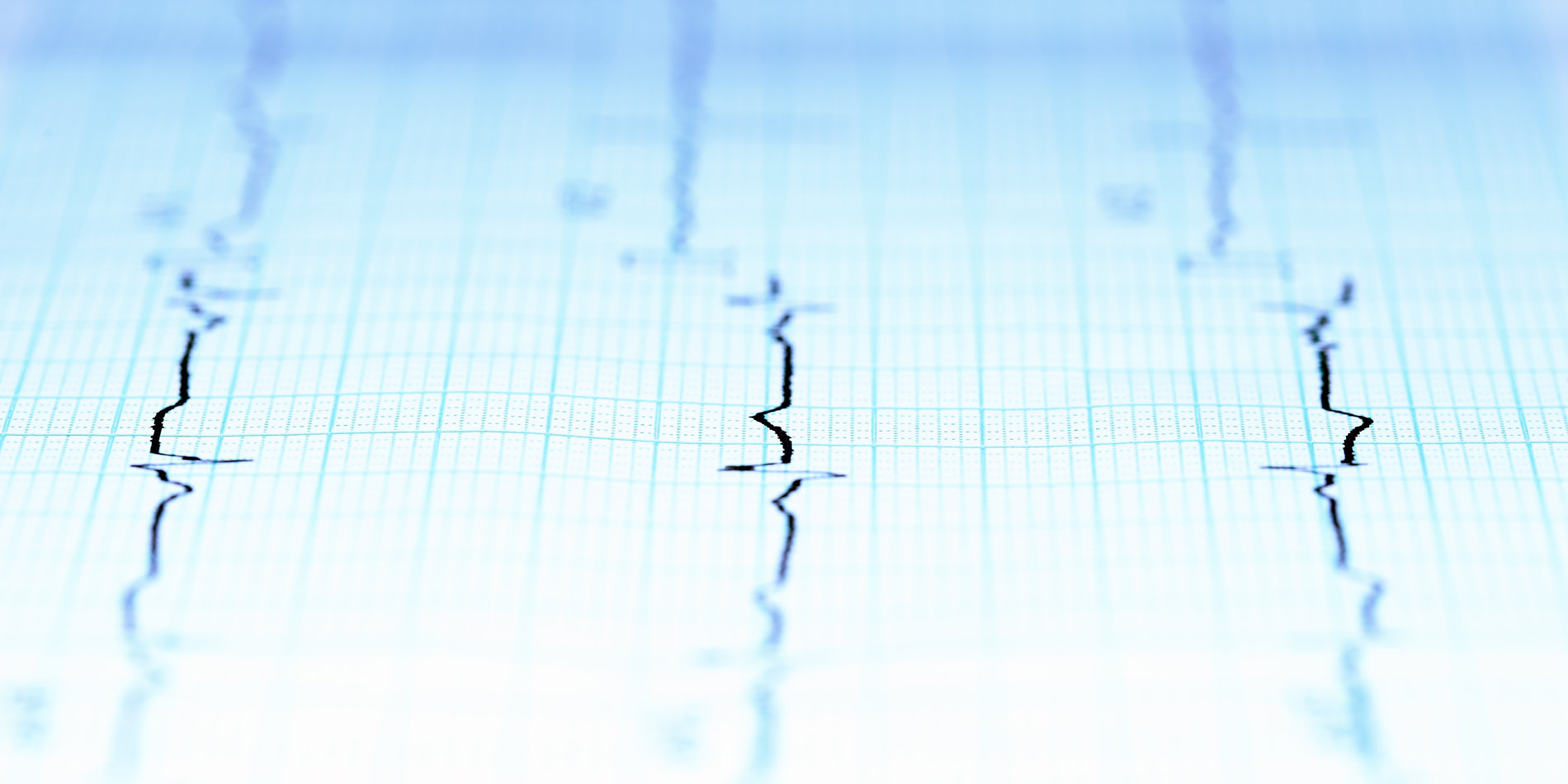 seismograph squiggles