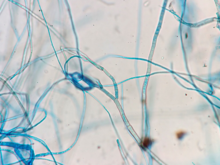 Microscope image with thin blue lines